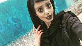 Inquietantes fotos: “Angelina Jolie zombie” comparte imágenes de su última cirugía  y su rostro luce cada vez más extraño