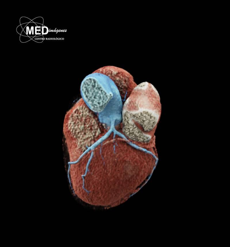 MEDimágenes: Nuevos estudios que observan a tu corazón con mayor detalle