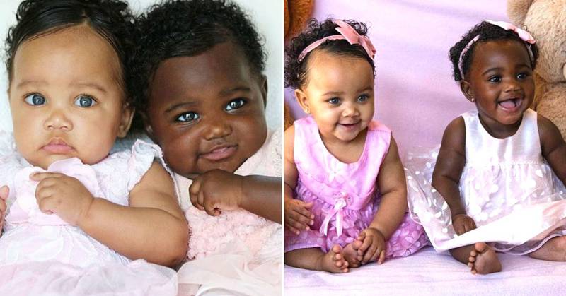 Isabella y Gabriella Shipley son los nombres de las gemelas con diferente color de piel |