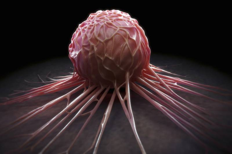 Getty Images/ Célula cancerígena
