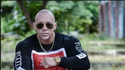 Harry "El Híbrido", bailarín, sufre graves quemaduras en su rostro por depilarse con cera