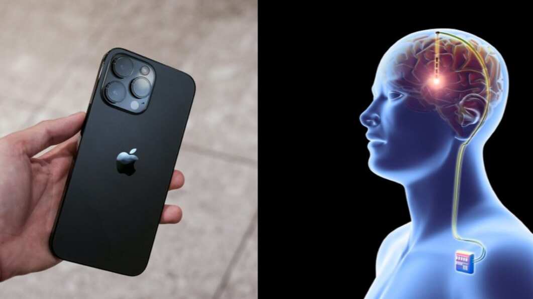 Apple da un salto al futuro: control mental de sus dispositivos con implantes cerebrales