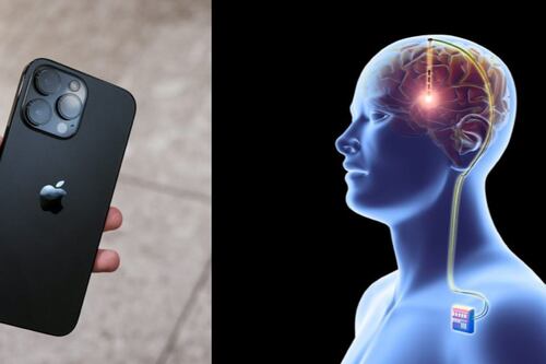 Apple da un salto al futuro: control mental de sus dispositivos con implantes cerebrales