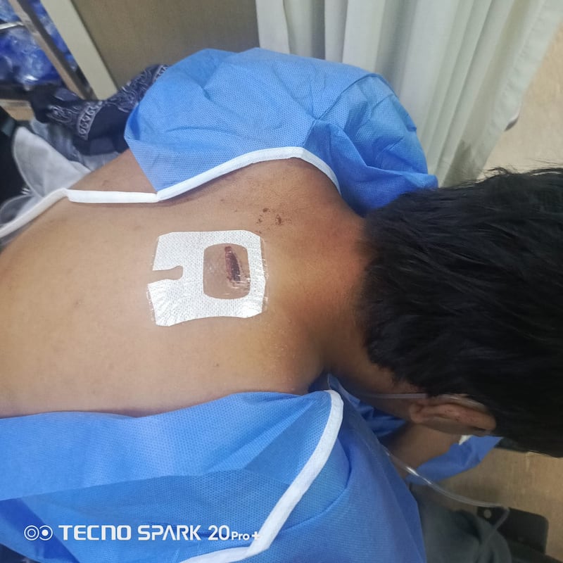 Estudiante fue apuñalado durante riña callejera en el parque de Alangasí, en Quito