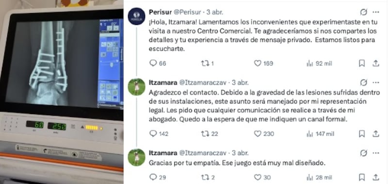 Subió a un juego infantil y resultó lesionada