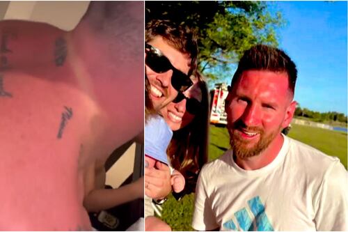 Messi y compañía quedaron más rojos que tomate por la insolada que se pegaron
