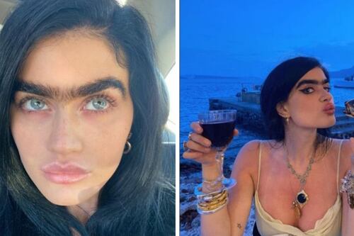 Esta modelo dejó de depilar su vello corporal y se convirtió en ejemplo de belleza natural