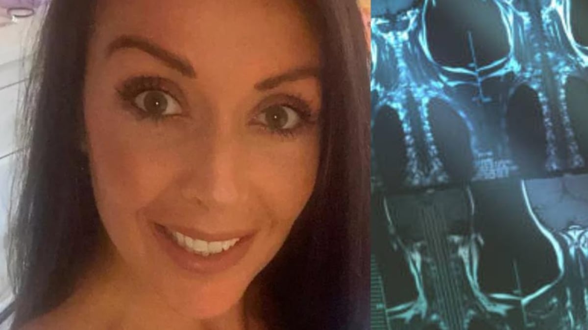 Le dieron resultados erróneos de una prueba médica y resultó ser cáncer