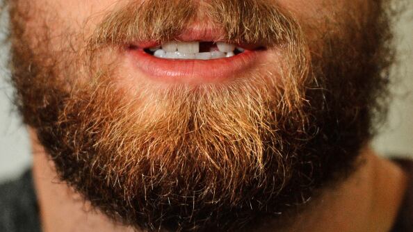 Soñar que se te caen los dientes