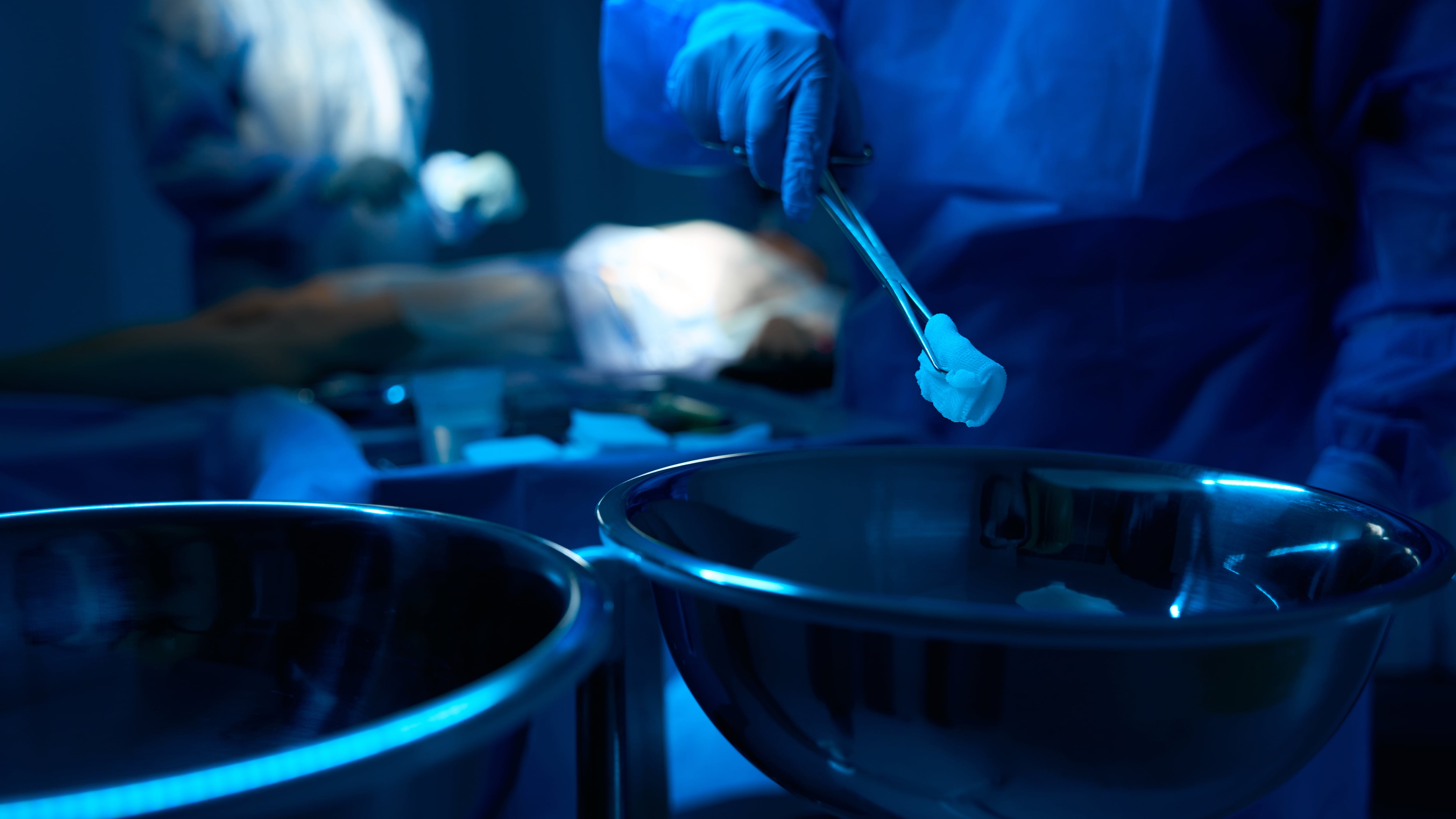 La mano del médico en un guante azul sostiene las pinzas con una almohadilla de algodón durante la operación