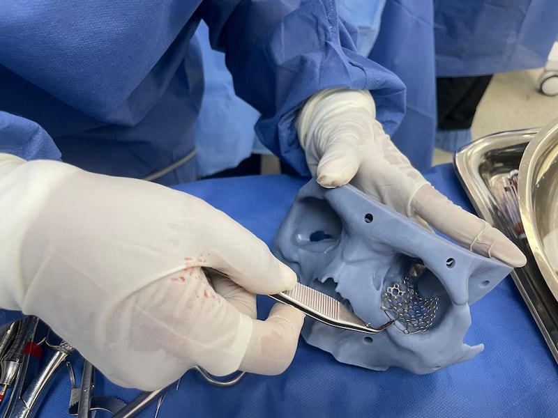 La intervención duró cerca de nueve horas y permitió reconstruir el rostro de un paciente con fracturas faciales severas consideradas de alta complejidad médica.