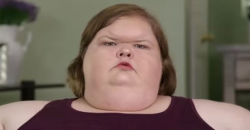 Tras bajar más de 200 kg, una de las hermanas de Kilos Mortales mostró el resultado de su cirugía de eliminación de piel.