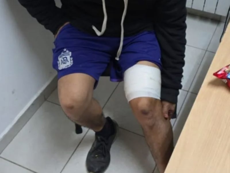 Va a tatuarse y el ex de la tatuadora lo confunde con su amante: lo apuñala y desata una tragedia