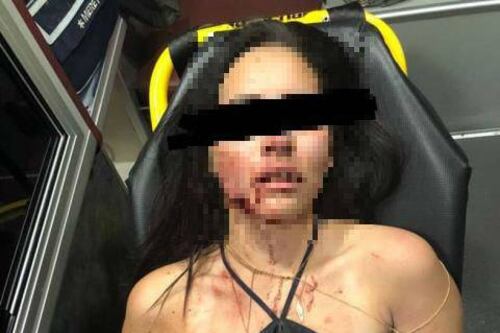 Karen fue mordida por su novio y ahora teme por su vida