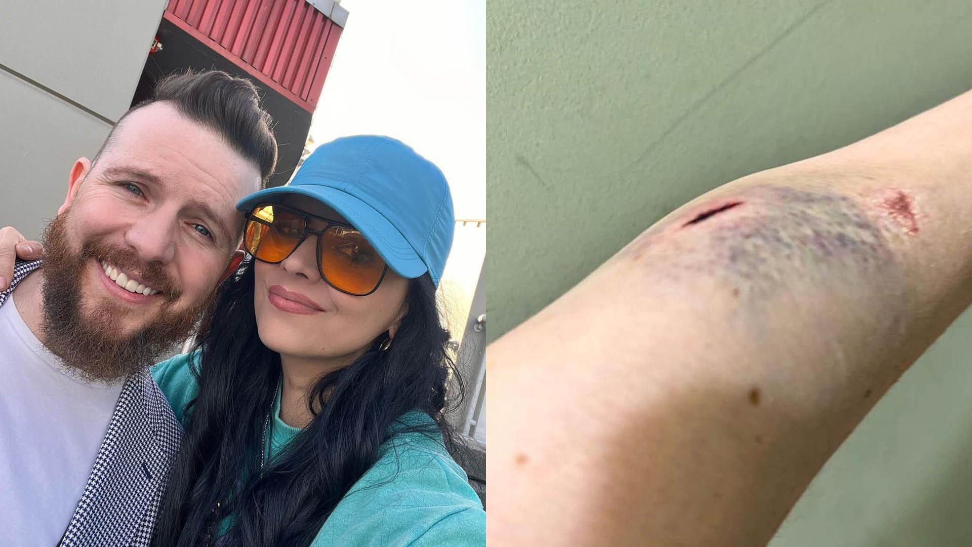 Daniel Habif y su esposa fueron brutalmente golpeados: "Nos atacaron con botellas de vidrio, escupitajos, insultos xenófobos"