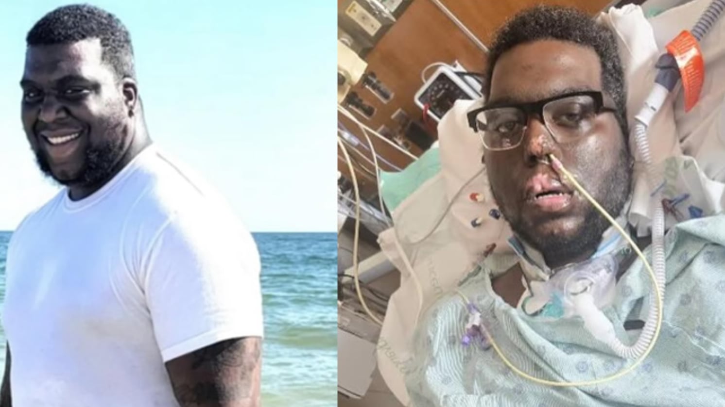 Hombre perdió sus brazos y piernas tras asistir a una revisión odontológica de rutina