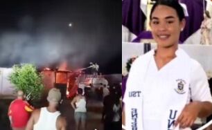 Roxana Parra, enfermera de 25 años, sobrevivió a ataque con gasolina de su expareja en Yaracuy.