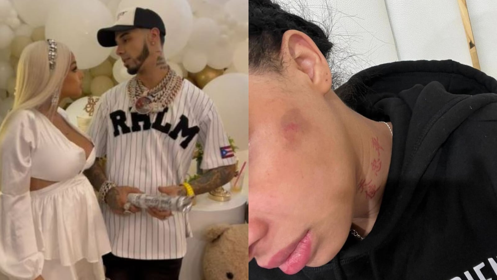 Yailin acusa a Anuel de golpearla mientras estaba embarazada