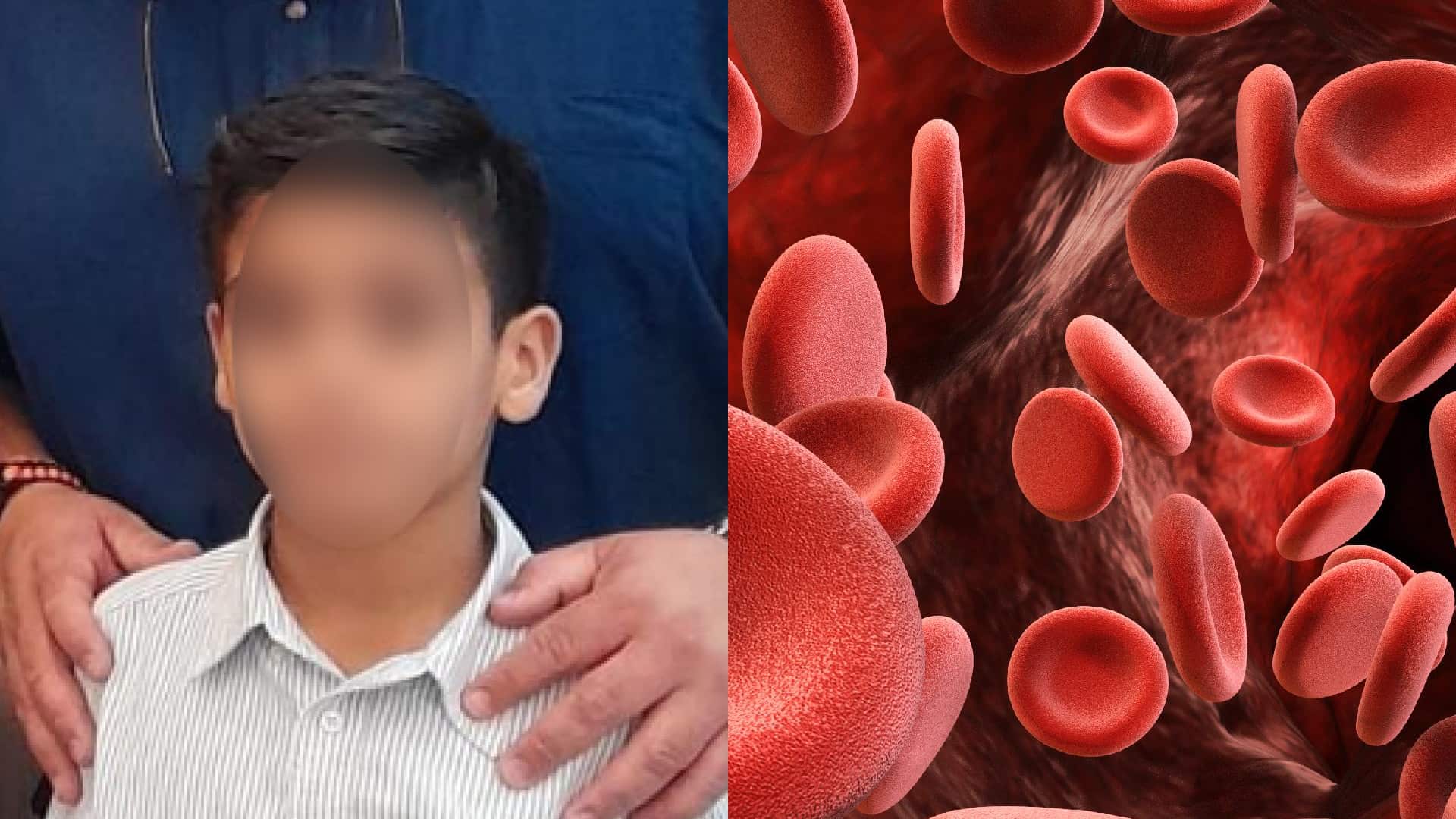 Alex, el niño que resiste al dolor mientras la hemofilia amenaza con quitarle las rodillas o la vida en Ecuador