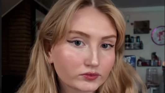 Joven de 20 años ignoró por años estos síntomas que resultó ser cáncer cerebral