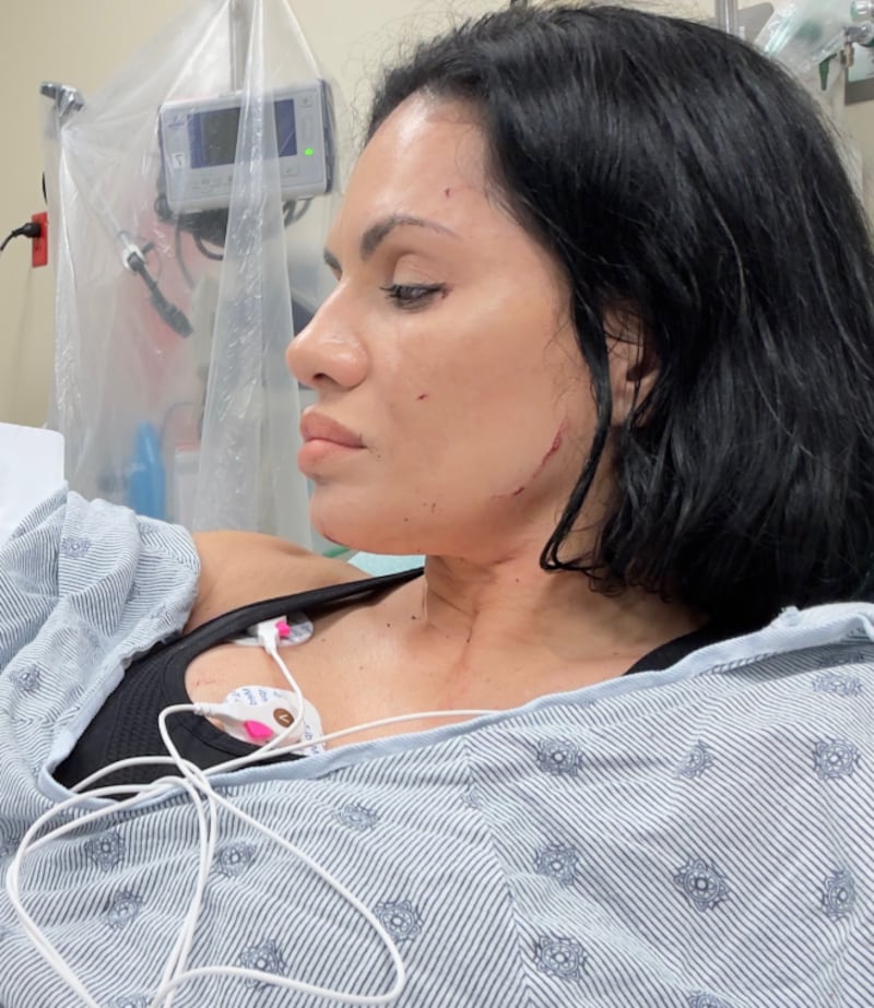 Heridas que influencers sufrieron
