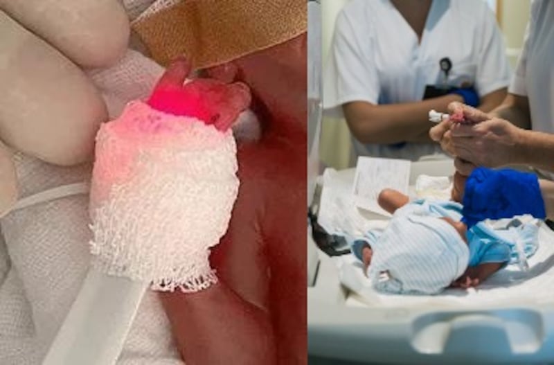 Bebé de 300 gramos sobrevive en hospital de Alemania