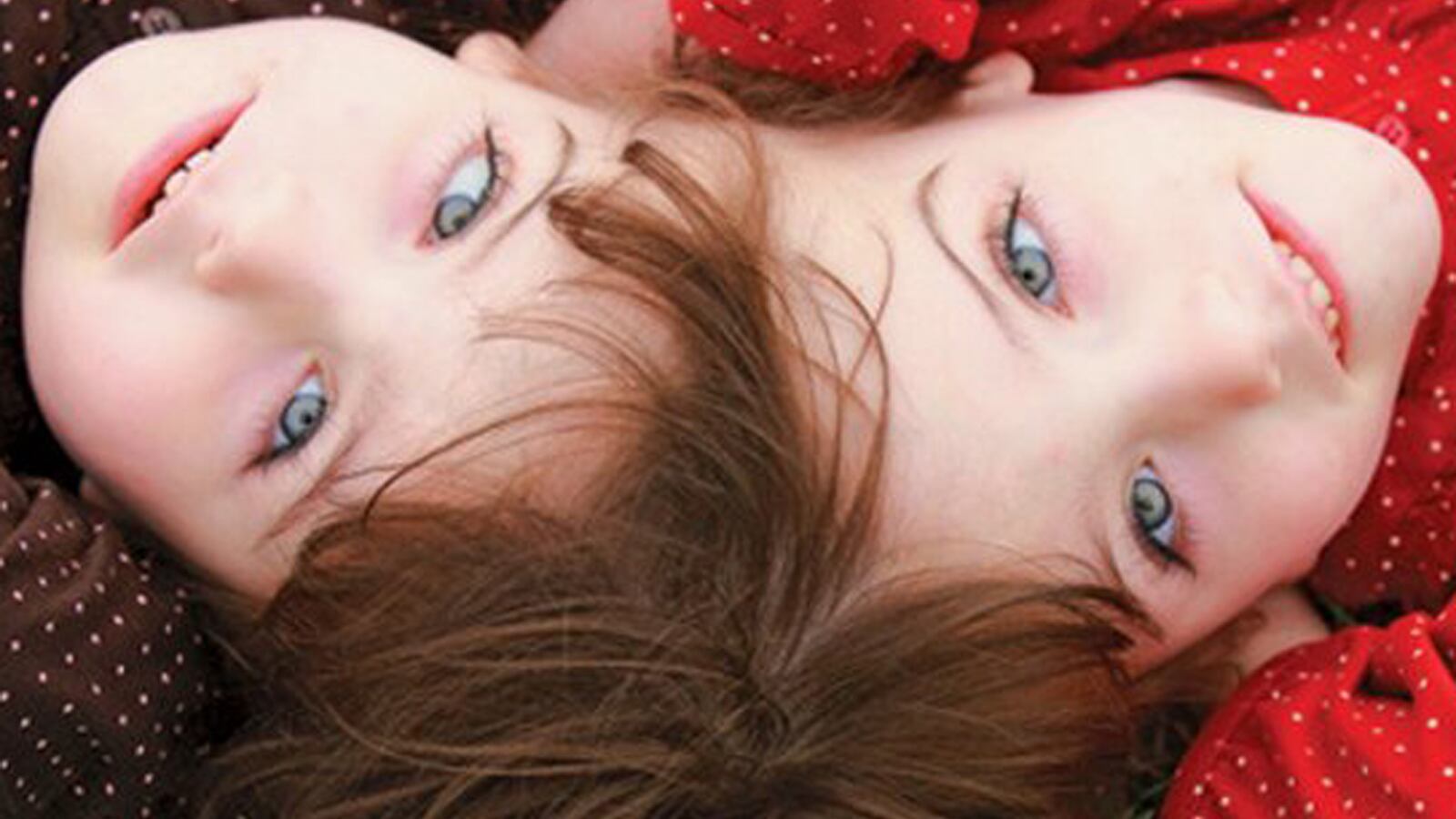 Conoce a Krista y Tatiana Hogan, las siamesas que comparten cerebro y pensamientos