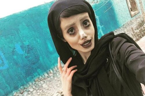 Inquietantes fotos: “Angelina Jolie zombie” comparte imágenes de su última cirugía  y su rostro luce cada vez más extraño