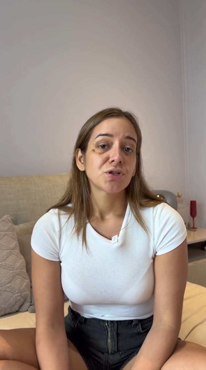Scarlett Córdova denuncia agresión física de su expareja