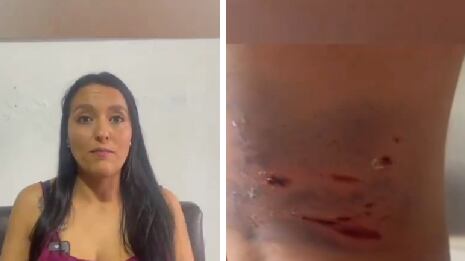 Habló dueña del perro pitbull sacrificado por la Policía de Manizales