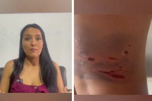 “Era él o éramos nosotros”: Habló la dueña del pitbull al que le disparó la Policía