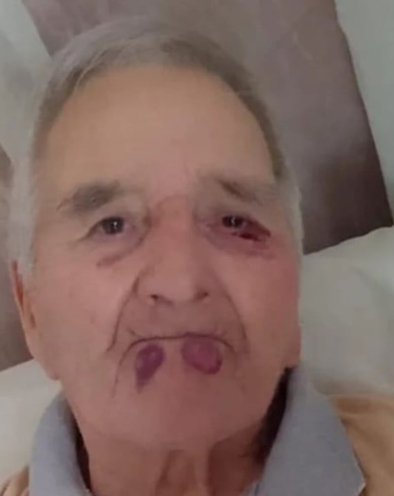 Agresión a adulto mayor en un geriátrico en Mar del Plata