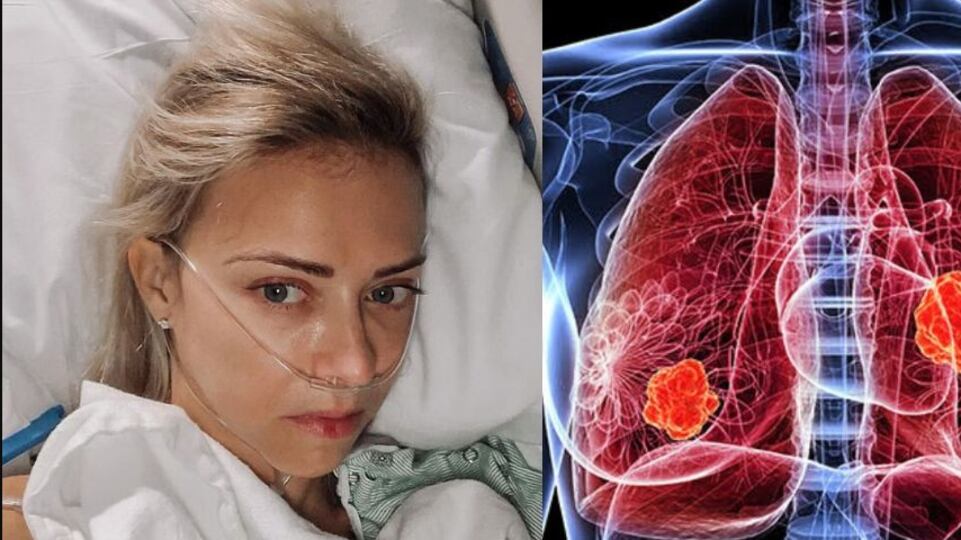 Creyó que era solo un dolor muscular, pero tenía cáncer en etapa 4 a los 37 años