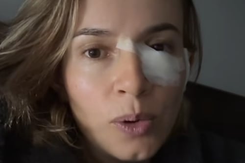 “Pensé que era un lunar y era cáncer de piel”: mujer cuenta su historia y explica por qué hay que ir al médico a tiempo