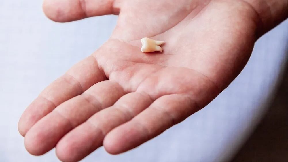 ¿Qué significa soñar que se me caen los dientes?