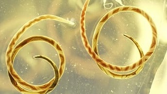 Angiostrongylus cantonensis