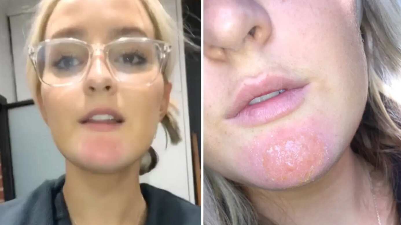 Tiktoker alerta por la falta de higiene en las barbas de los hombres.