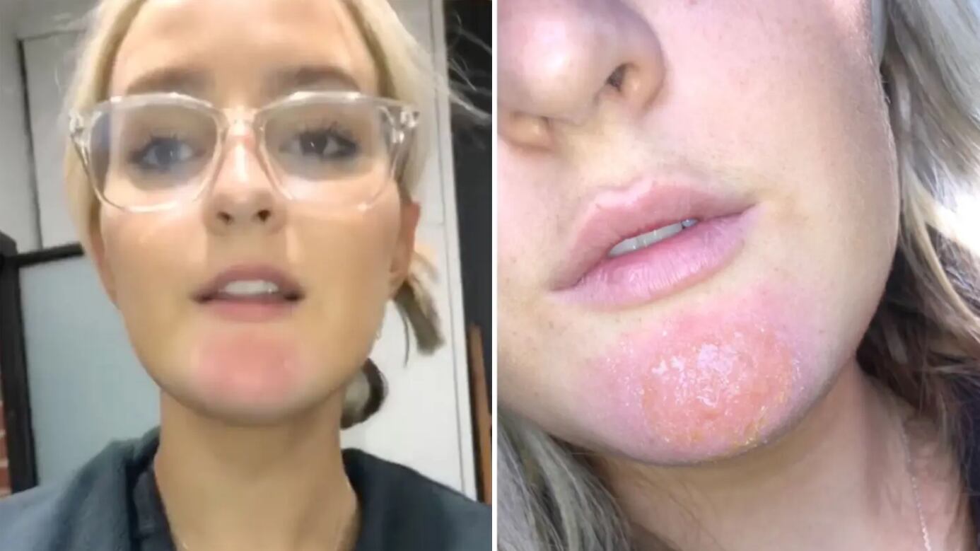 Tiktoker alerta por la falta de higiene en las barbas de los hombres.