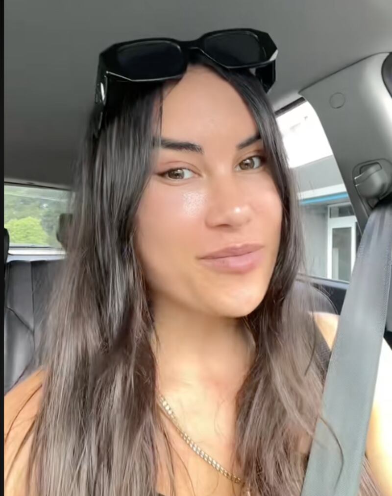 Lourissa Setu muestra los resultados de su mini lifting facial, reducción de frente y cirugía de ojos de zorro.