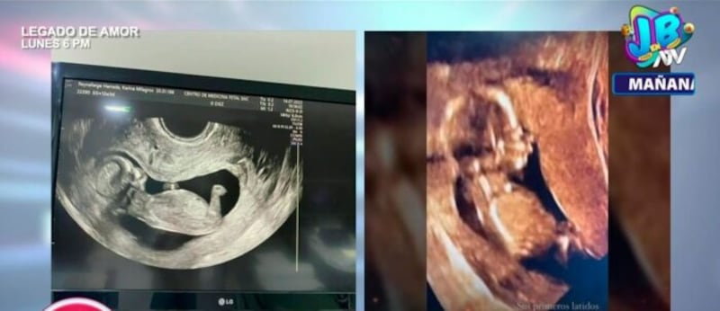 Gabriela Sevilla mostró ecografías falsas a su pareja, asegura ginecólogo que la atendió y denuncia que falsificó su sello médico