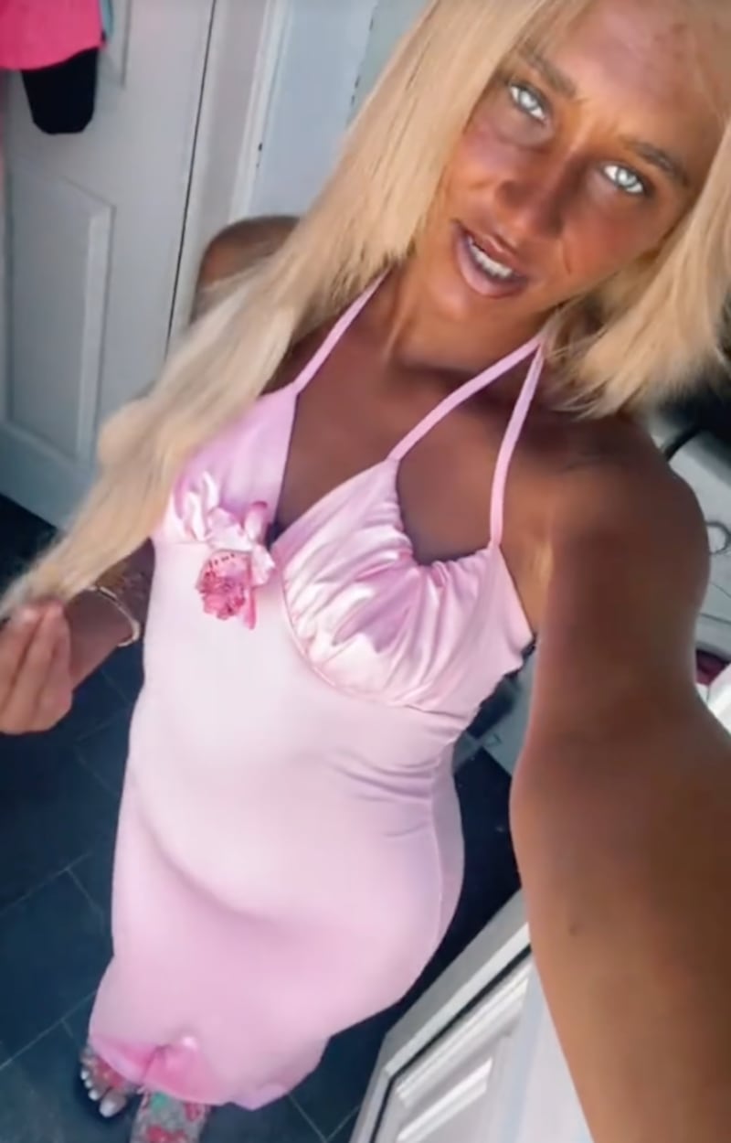 Megan Blain muestra su piel manchada por bronceado extremo