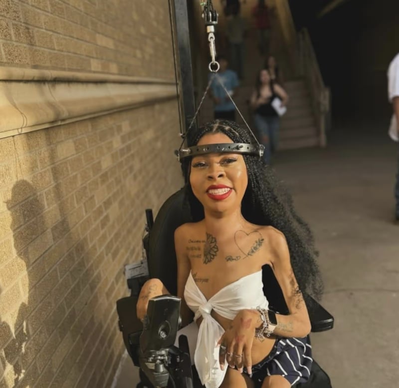 Mujer tiene 15 tornillos colocados en el cráneo para mantenerse con vida: no le daban más de 7 años. Captura de pantalla