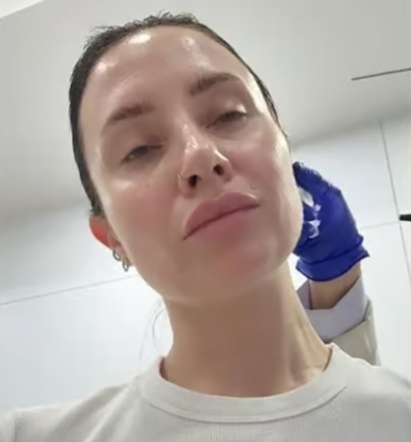 Mujer descubrió que tenía una hormiga en su oído tras escuchar ruidos extraños - Fuente: Foto de la web