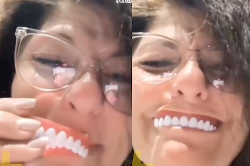 VIDEO: Compró dientes postizos en Shein y TikTok no deja de reír