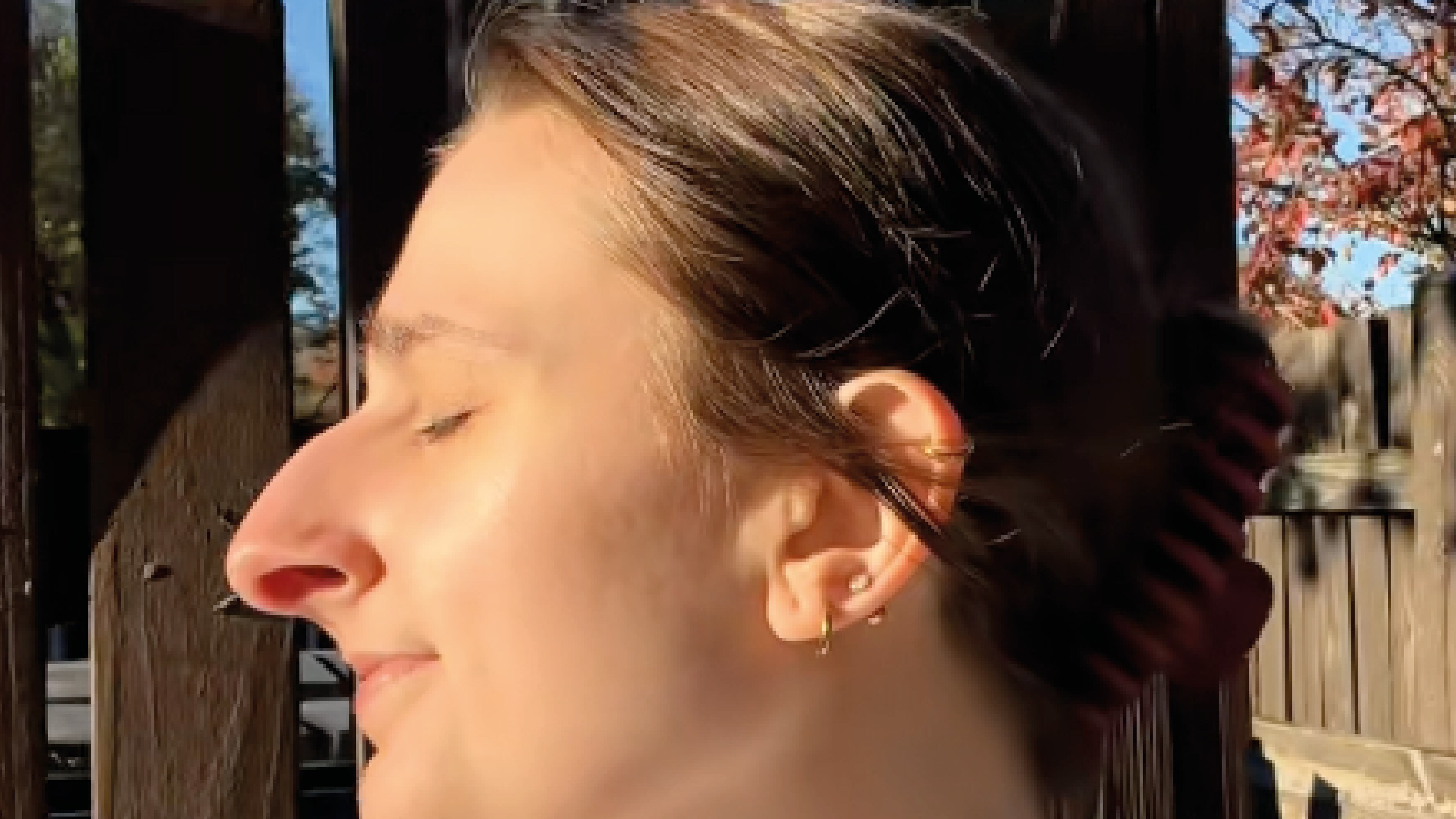 Devyn Aiken: la mujer que ahorró 10 años para una rinoplastia que transformó su vida