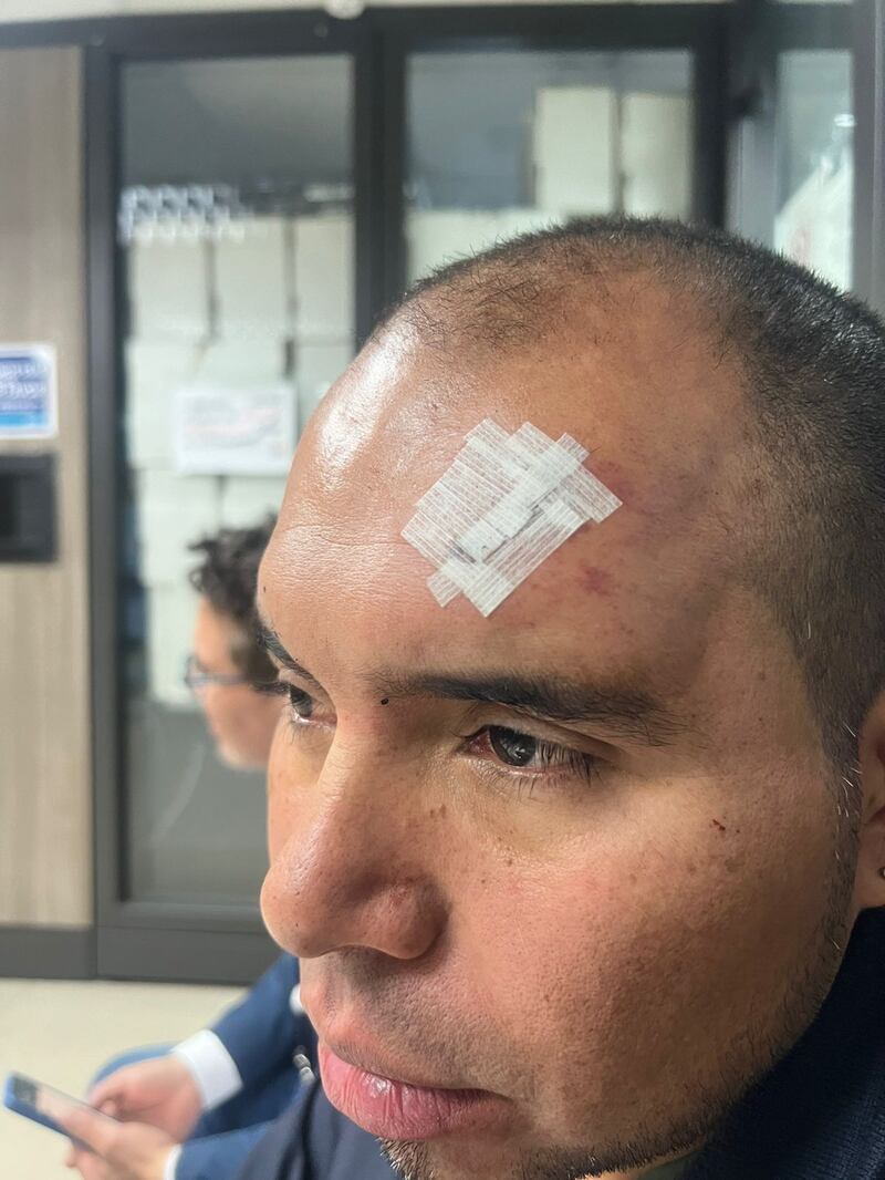 Secuelas de las víctimas de abuso policial al norte de Quito