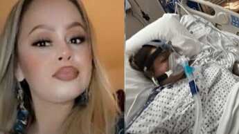 Mujer comió tilapia poco cocida y le tuvieron que amputar sus extremidades ¿Qué sucedió?