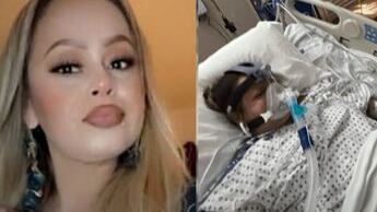 Mujer comió tilapia poco cocida y le tuvieron que amputar sus extremidades ¿Qué sucedió?