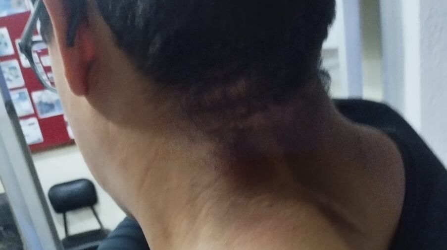 Hombre intentó robar a un taxista mordiéndolo en Quito