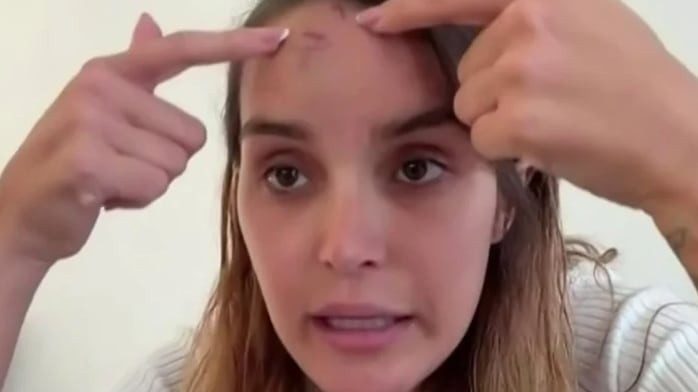 Andrea del Val, Miss Venezuela 2025, rompe el silencio tras ser agredida por el estilista de Fátima Bosch